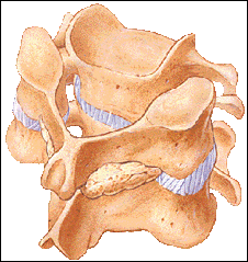 Posterior Cervical Fusion